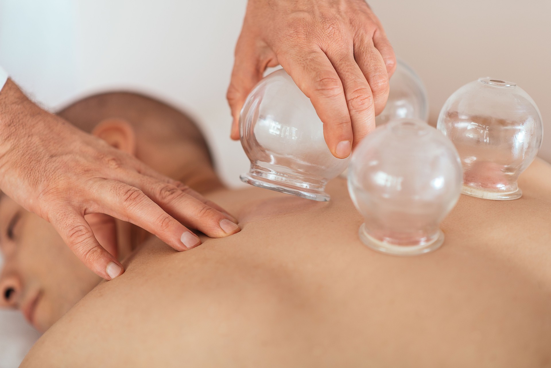 Massage cupping therapy